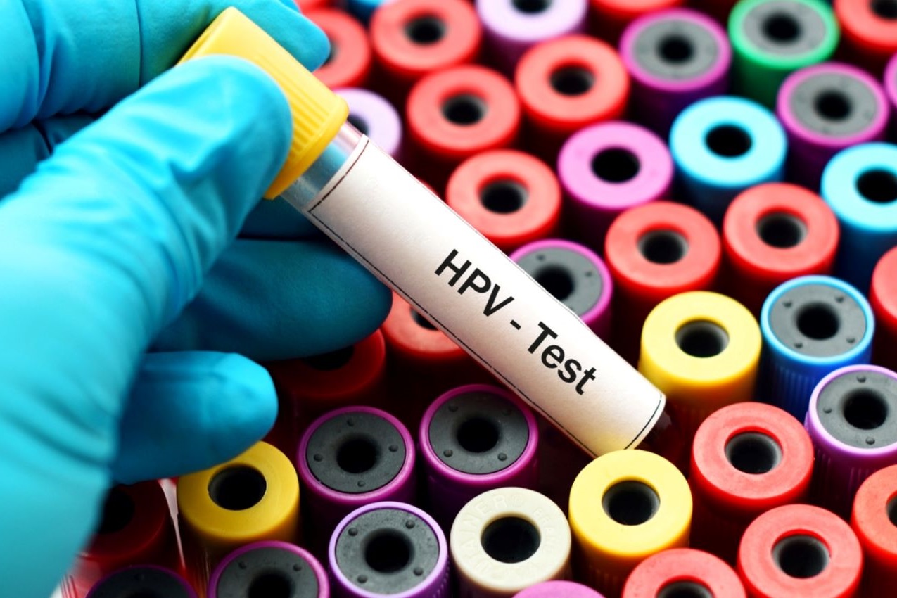 hpv-test